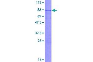 Image no. 1 for Bone Morphogenetic Protein 3 (BMP3) (AA 1-472) protein (GST tag) (ABIN1346759)