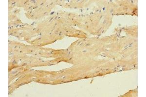 Immunohistochemistry of paraffin-embedded human heart tissue using ABIN7175582 at dilution of 1:100 (CACNA2D4 anticorps  (AA 934-1115))