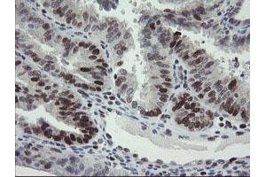 Image no. 5 for anti-Replication Factor C (Activator 1) 2, 40kDa (RFC2) (AA 1-234) antibody (ABIN1490616)