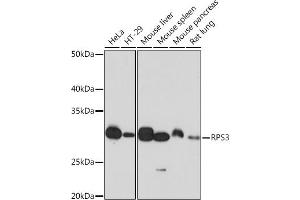 Western blot analysis of extracts of various cell lines, using RPS3 Rabbit mAb (ABIN7270025) at 1:1000 dilution. (RPS3 anticorps)