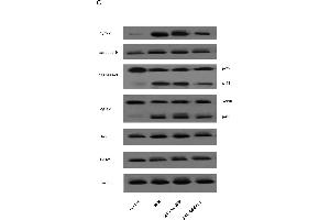 Elevation of Srx-1 attenuated SI/R-triggered mitochondrial apoptosis pathwayAfter transfection with Ad-Srx-1, cells were then exposure to SI/R.