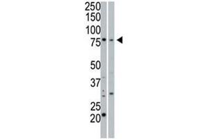 cGKI beta antibody used in western blot to detect cGKIbeta in 293 cell lysate (Lane 1) and mouse small intestine tissue lysate (2). (PRKG1 anticorps  (AA 629-660))