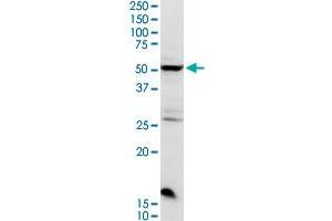 CHRDL2 MaxPab rabbit polyclonal antibody. (CHRDL2 anticorps  (AA 1-451))
