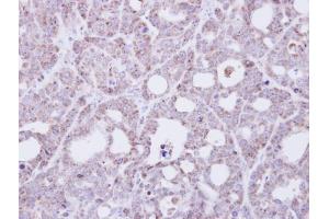 anti-Transmembrane Protein 147 (TMEM147) antibody