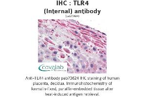 Image no. 1 for anti-Toll-Like Receptor 4 (TLR4) (Internal Region) antibody (ABIN1740115) (TLR4 anticorps  (Internal Region))