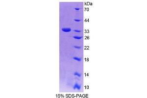 SDS-PAGE (SDS) image for NAD(P)H Dehydrogenase, Quinone 1 (NQO1) (AA 2-273) protein (His tag) (ABIN6236473)
