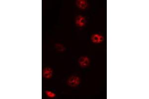 ABIN6272469 staining HepG2 by IF/ICC. (ZNF785 anticorps)