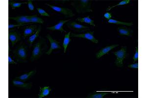 Immunofluorescence of monoclonal antibody to FMN1 on HeLa cell. (FMN1 anticorps  (AA 1-109))