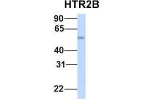 Host:  Rabbit  Target Name:  HTR2B  Sample Type:  Human Fetal Muscle  Antibody Dilution:  1.
