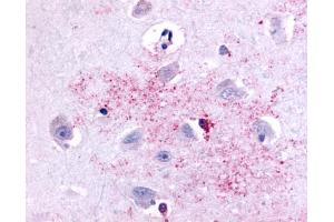 Anti-PAK6 antibody IHC of human brain, neurons and glia. (PAK6 anticorps  (Linker Domain))