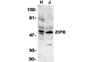 Western Blotting (WB) image for anti-Death-Associated Protein Kinase 3 (DAPK3) (Middle Region) antibody (ABIN1031183) (DAPK3 anticorps  (Middle Region))