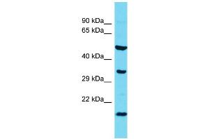 Host: Rabbit  Target Name: l7Rn6  Sample Tissue: Rat Spleen lysates  Antibody Dilution: 1. (C11orf73 anticorps  (N-Term))