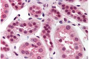 Human Kidney (formalin-fixed, paraffin-embedded) stained with SKI antibody ABIN214477 at 2.