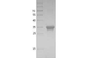 Western Blotting (WB) image for Mitogen-Activated Protein Kinase Kinase 1 (MAP2K1) (AA 1-58) protein (GST tag) (ABIN7123997) (MEK1 Protein (AA 1-58) (GST tag))