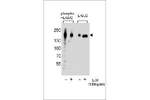 Western blot analysis of extracts from A431 cells, untreated or treated with EGF, 100 ng/mL, using Phospho-ERBB2- or ERBB2 Antibody (right).