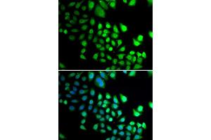 Immunofluorescence analysis of U2OS cells using RBBP5 antibody (ABIN5974189). (RBBP5 anticorps)