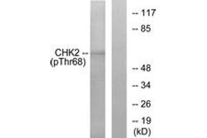Western blot analysis of extracts from Jurkat cells treated with UV, using Chk2 (Phospho-Thr68) Antibody. (CHEK2 anticorps  (pThr68))