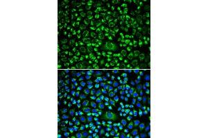 Immunofluorescence analysis of HeLa cells using TAPBP antibody (ABIN6132744, ABIN6148847, ABIN6148849 and ABIN6217320). (TAPBP anticorps  (AA 30-260))