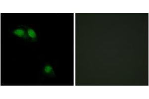 Immunofluorescence analysis of HeLa cells, using IRS-1 (Phospho-Ser312) Antibody.