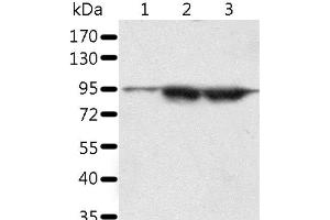 Western Blot analysis of A549 and lncap cell, Human seminoma tissue using SPATA20 Polyclonal Antibody at dilution of 1:1000 (SPATA20 anticorps)