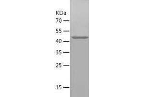 Western Blotting (WB) image for Squalene Epoxidase (SQLE) (AA 49-275) protein (His-IF2DI Tag) (ABIN7125197)