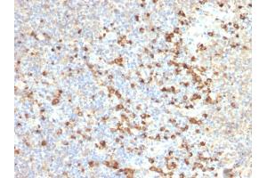 Formalin-fixed, paraffin-embedded human Tonsil stained with TIM3 Mouse Monoclonal Antibody (TIM3/2399). (TIM3 anticorps  (AA 22-202))