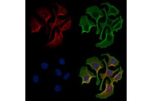 ABIN6257870 and ABIN6274447 staining Hela cells by IF/ICC.