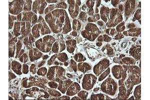 Image no. 5 for anti-Musashi Homolog 2 (MSI2) antibody (ABIN1499578)