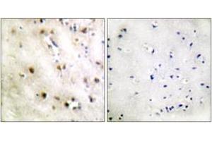 Immunohistochemistry analysis of paraffin-embedded human brain tissue, using TISB (Ab-92) Antibody. (ZFP36L1 anticorps  (AA 58-107))