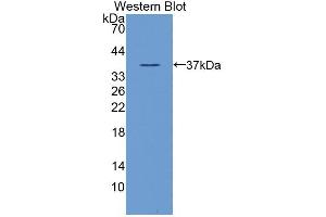 Western blot analysis of the recombinant protein. (NDRG2 anticorps  (AA 2-300))