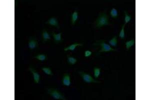 Image no. 1 for anti-Cancer/testis Antigen 1B (CTAG1B) antibody (ABIN1499895) (CTAG1B anticorps)