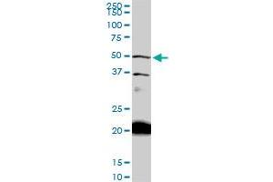 NADK monoclonal antibody (M01), clone 5F4. (NADK anticorps  (AA 1-446))
