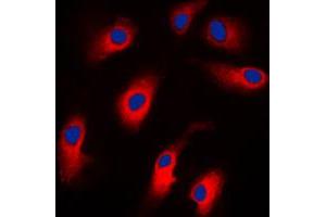 Immunofluorescent analysis of Caspase 7 staining in Jurkat cells. (Caspase 7 anticorps  (N-Term))
