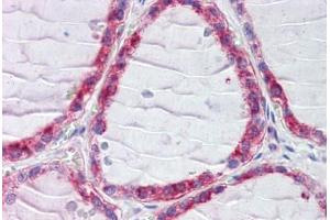 Human Thyroid (formalin-fixed, paraffin-embedded) stained with CLIP1 antibody ABIN462301 followed by biotinylated secondary antibody, alkaline phosphatase-streptavidin and chromogen. (CLIP1 anticorps  (AA 1404-1417))