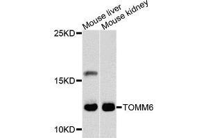 Western blot analysis of extracts of mouse liver and mouse kidney cells, using TOMM6 antibody. (TOMM6 anticorps)