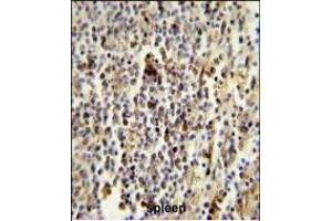 CD1E Antibody (Center) (ABIN653900 and ABIN2843142) immunohistochemistry analysis in formalin fixed and paraffin embedded human spleen followed by peroxidase conjugation of the secondary antibody and DAB staining.