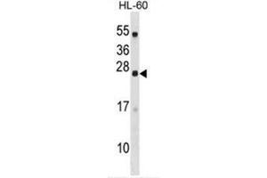 C18orf26 Antibody (N-term) western blot analysis in HL-60 cell line lysates (35µg/lane). (DYNAP anticorps  (N-Term))