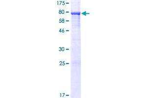 Image no. 1 for Smith-Magenis Syndrome Chromosome Region, Candidate 7 (SMCR7) (AA 1-454) protein (GST tag) (ABIN1320670)