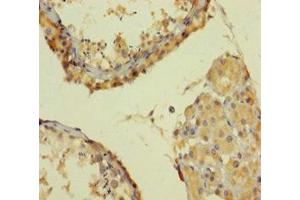 Immunohistochemistry of paraffin-embedded human testis tissue using ABIN7164521 at dilution of 1:100 (SMARCA2 anticorps  (AA 700-1216))