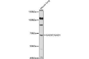 Western blot analysis of extracts of Mouse lung, using (ABIN3017018, ABIN3017019, ABIN3017020 and ABIN6219924) at 1:1000 dilution.