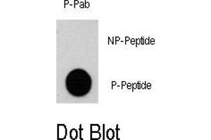 Image no. 1 for anti-Ribosomal Protein S6 Kinase, 90kDa, Polypeptide 3 (RPS6KA3) (pSer369) antibody (ABIN358394) (RPS6KA3 anticorps  (pSer369))