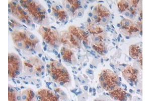 IHC-P analysis of Human Stomach Tissue, with DAB staining. (CCL8 anticorps  (AA 1-99))