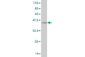 Western Blot detection against Immunogen (36. (HOXA5 anticorps  (AA 171-270))
