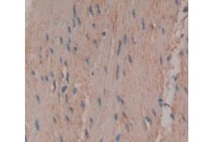 IHC-P analysis of Human Tissue, with DAB staining. (TNNT3 anticorps  (AA 147-269))