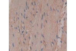 IHC-P analysis of Human Tissue, with DAB staining.