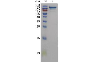 Human SD Protein, His Tag on SDS-PAGE under reducing condition.