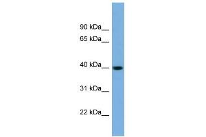 WB Suggested Anti-SAE1 Antibody Titration: 0. (SAE1 anticorps  (N-Term))