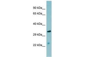 Image no. 1 for anti-Mannan-Binding Lectin serine Peptidase 2 (MASP2) (AA 35-84) antibody (ABIN6741648) (MASP2 anticorps  (AA 35-84))