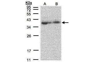 WB Image Sample(30 μg of whole cell lysate) A:293T B:A431, 12% SDS PAGE antibody diluted at 1:500 (MRPL3 anticorps  (C-Term))