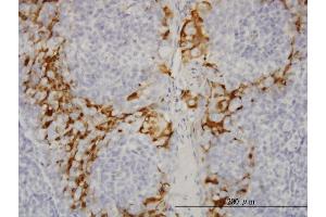 Immunoperoxidase of monoclonal antibody to GSTA3 on formalin-fixed paraffin-embedded human tonsil.